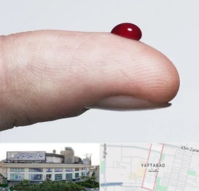 مرکز فصد خون در یافت آباد