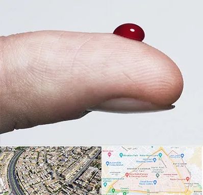 مرکز فصد خون در شهرک غرب مشهد