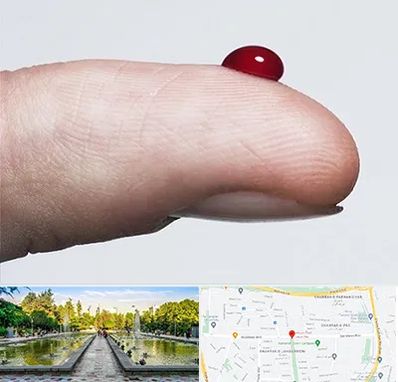 مرکز فصد خون در سرسبز