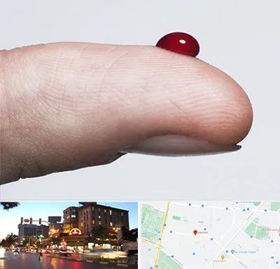 مرکز فصد خون در بلوار سجاد مشهد