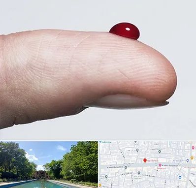 مرکز فصد خون در هشت بهشت اصفهان