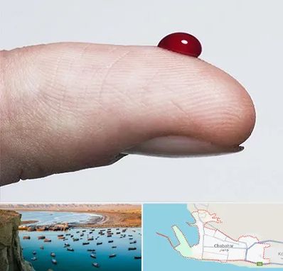 مرکز فصد خون در چابهار