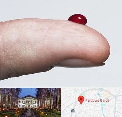 مرکز فصد خون در باغ فردوس