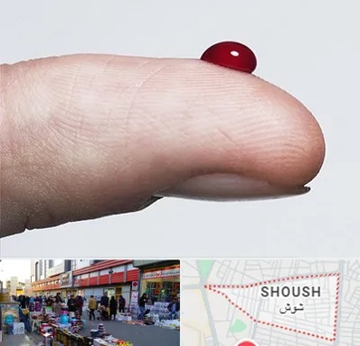 مرکز فصد خون در شوش