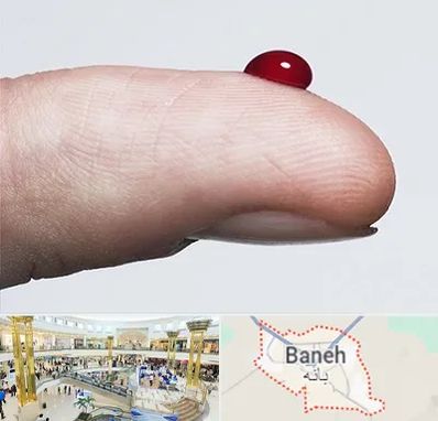 مرکز فصد خون در بانه