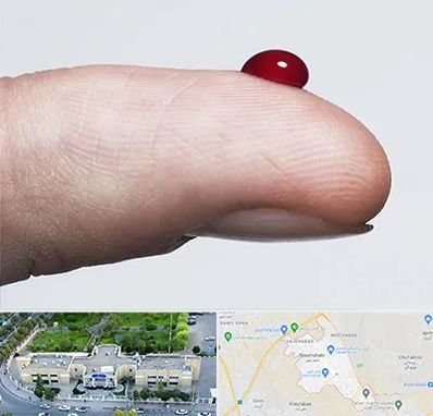 مرکز فصد خون در نسیم شهر