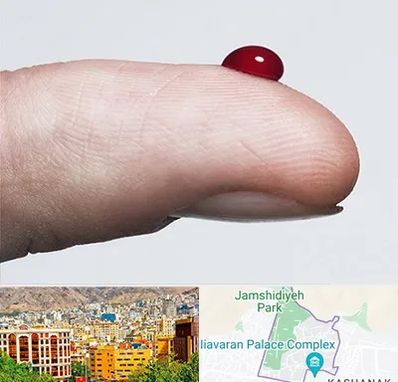 مرکز فصد خون در نیاوران 