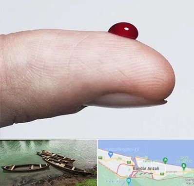 مرکز فصد خون در بندر انزلی