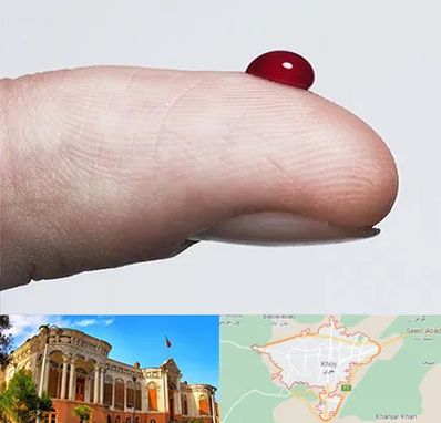 مرکز فصد خون در خوی