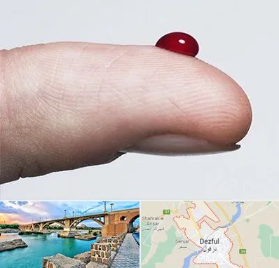 مرکز فصد خون در دزفول