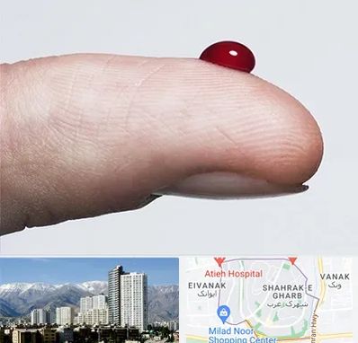 مرکز فصد خون در شهرک غرب 