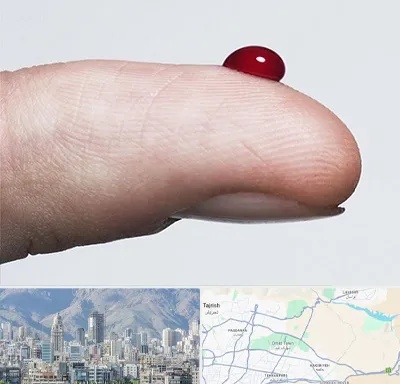 مرکز فصد خون در شمال شرق تهران
