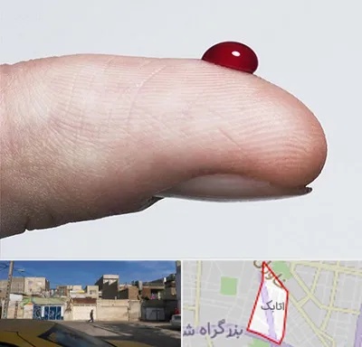 مرکز فصد خون در اتابک
