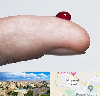 مرکز فصد خون در میانه