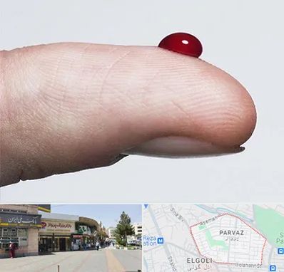 مرکز فصد خون در پرواز تبریز