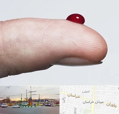 مرکز فصد خون در میدان خراسان