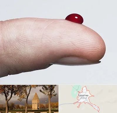 مرکز فصد خون در تویسرکان