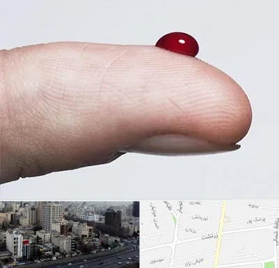 مرکز فصد خون در زرتشت