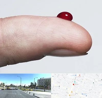 مرکز فصد خون در بلوار کلاهدوز مشهد