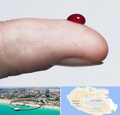 مرکز فصد خون در کیش