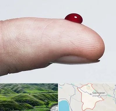 مرکز فصد خون در گچساران