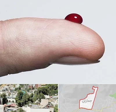 مرکز فصد خون در جماران