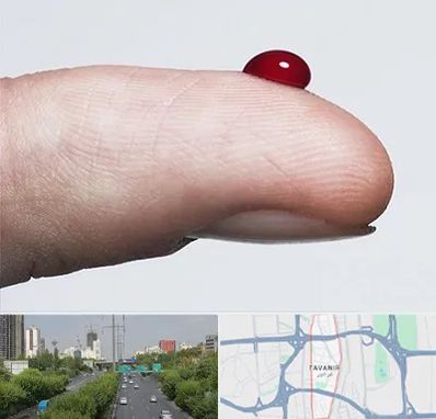 مرکز فصد خون در توانیر