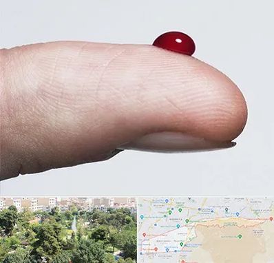 مرکز فصد خون در منطقه 13 تهران