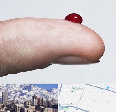 مرکز فصد خون در ازگل