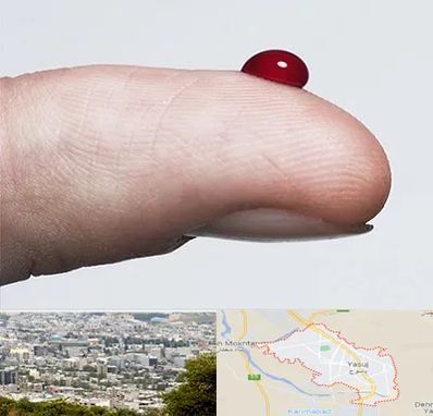 مرکز فصد خون در یاسوج