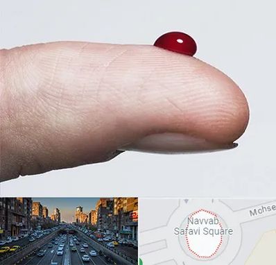 مرکز فصد خون در نواب