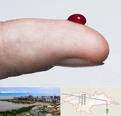 مرکز فصد خون در بندر ترکمن
