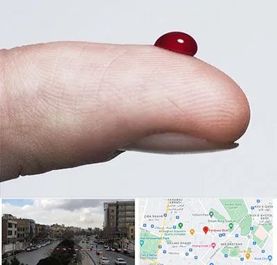 مرکز فصد خون در بلوار فردوسی مشهد