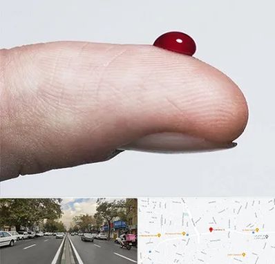 مرکز فصد خون در دولت