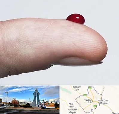 مرکز فصد خون در تایباد