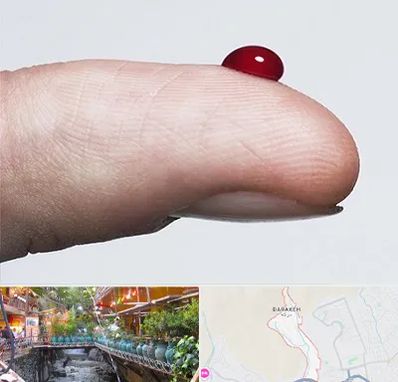 مرکز فصد خون در درکه