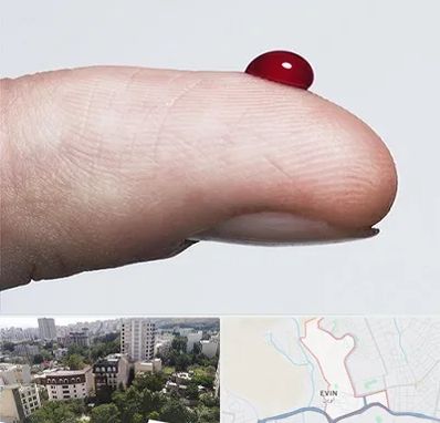 مرکز فصد خون در اوین