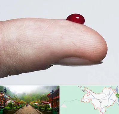 مرکز فصد خون در فومن