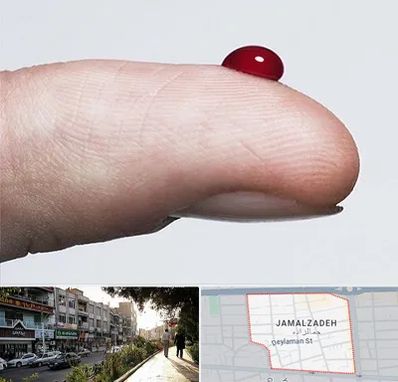 مرکز فصد خون در خیابان جمالزاده