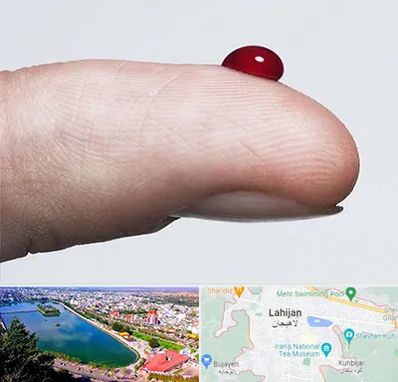 مرکز فصد خون در لاهیجان