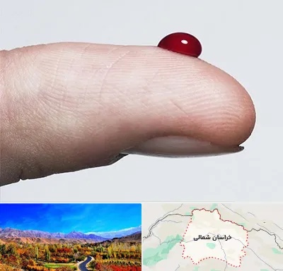 مرکز فصد خون در خراسان شمالی