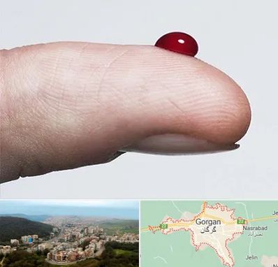 مرکز فصد خون در گرگان