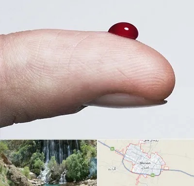 مرکز فصد خون در شیروان