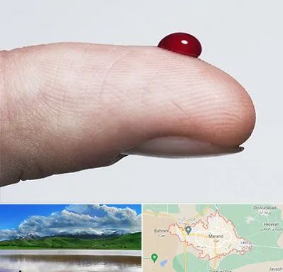 مرکز فصد خون در مرند