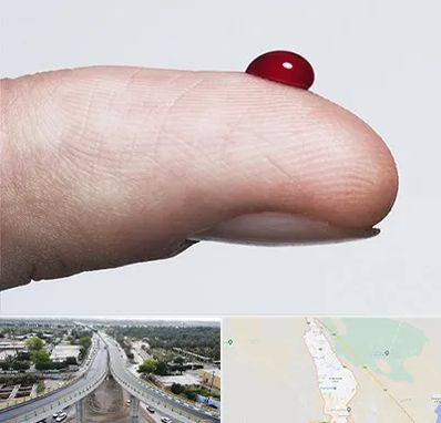 مرکز فصد خون در اندیمشک