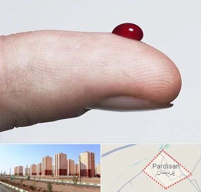 مرکز فصد خون در پردیسان قم