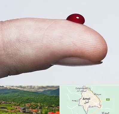 مرکز فصد خون در آمل