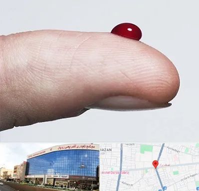 مرکز فصد خون در نصف راه تبریز