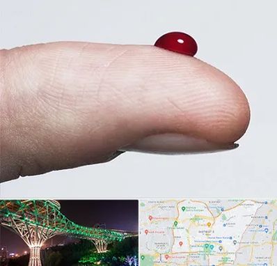 مرکز فصد خون در منطقه 3 تهران