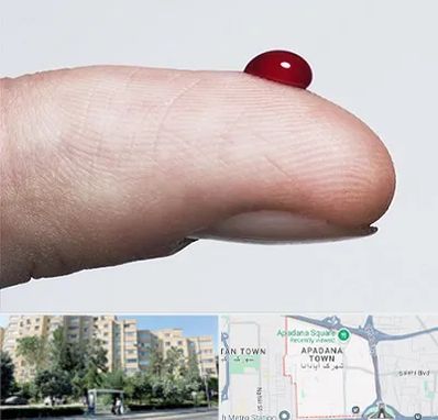 مرکز فصد خون در آپادانا